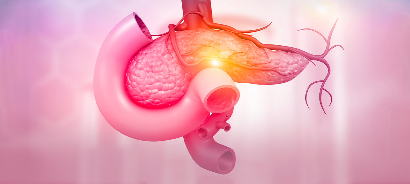 Image de la pancreatite chronique